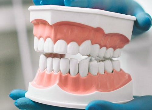 False Teeth Prices