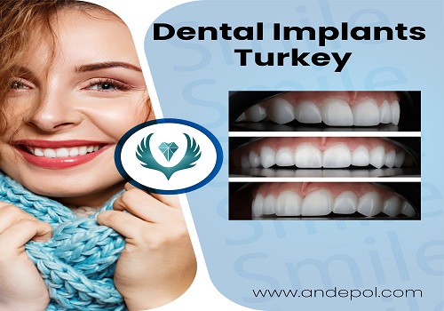 Full Mouth Dental Implants Turkey Package Deals and Prices