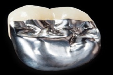 Metal Porselen Kron