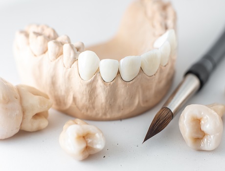 4 in 1 Monolithic Zirconia