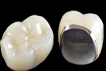 4 in 1 Porcelain Fused to Metal