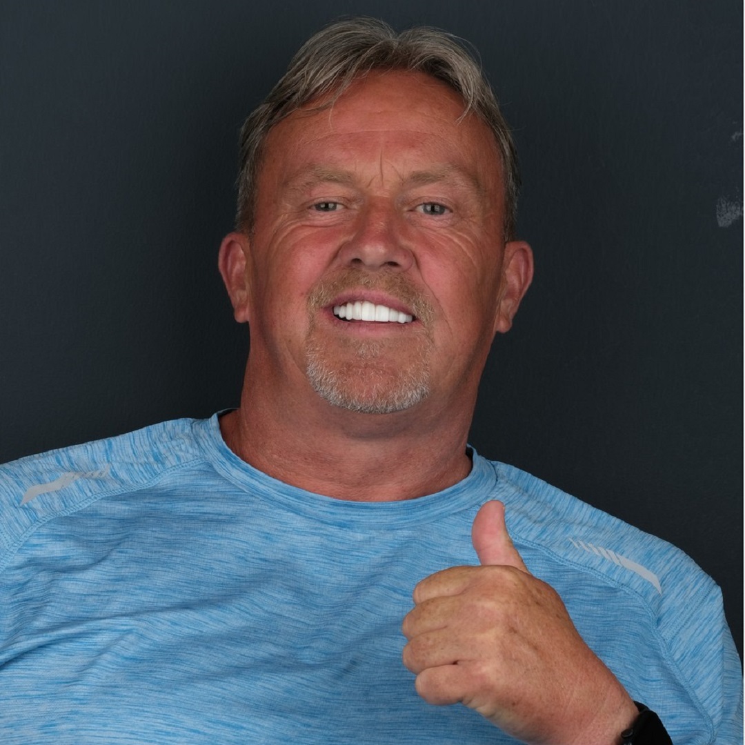 David have Dental implants and crowns in Turkey installed