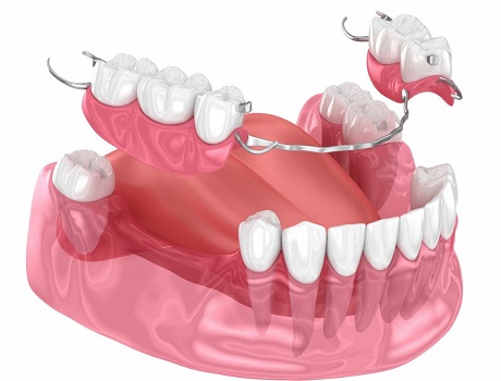 Dentures Prosthetic Teeth