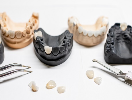 Monolitik zirconia 