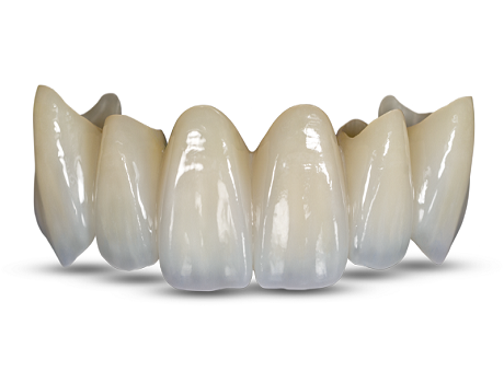 Zirconia Crown